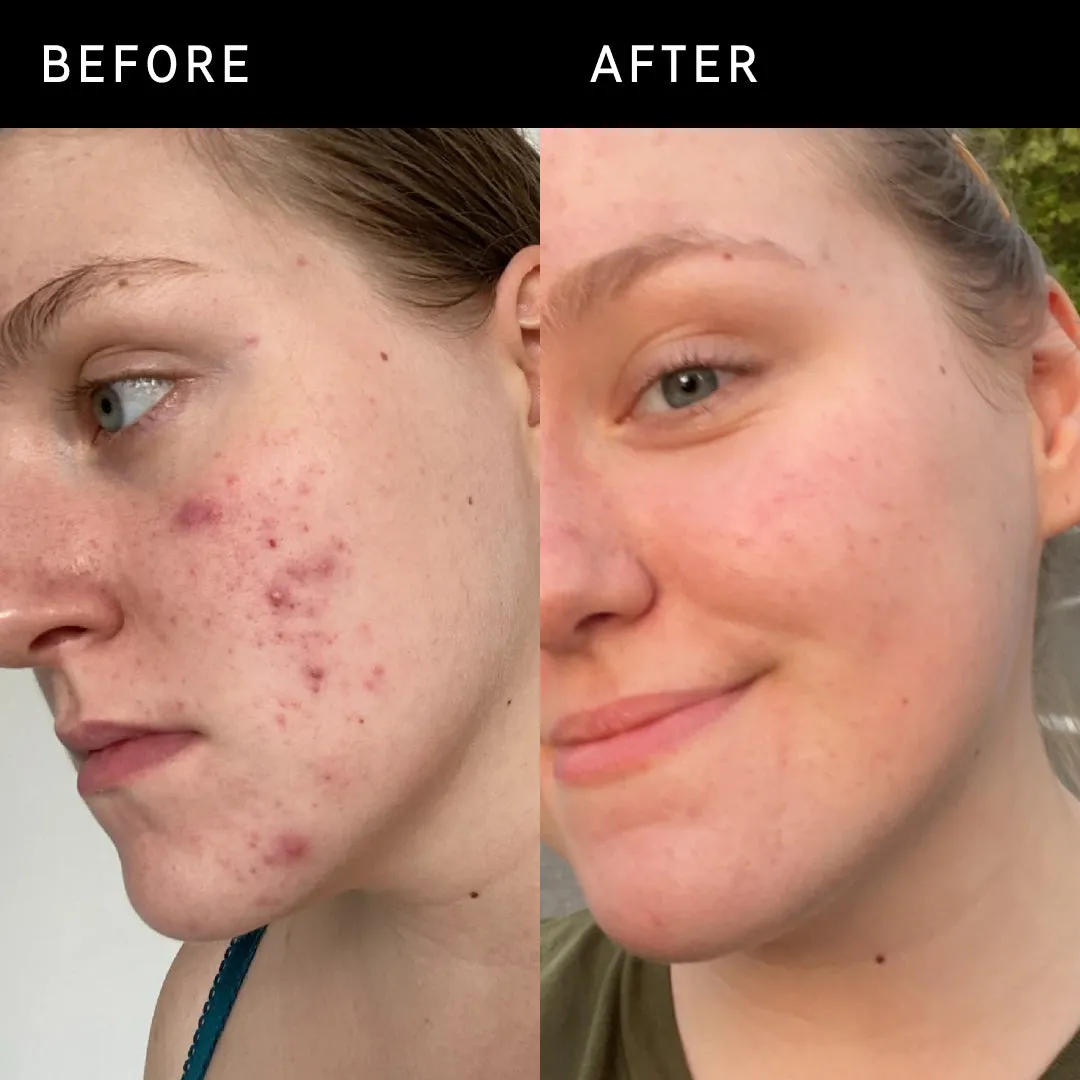 15% Vitamin C   EGF Serum