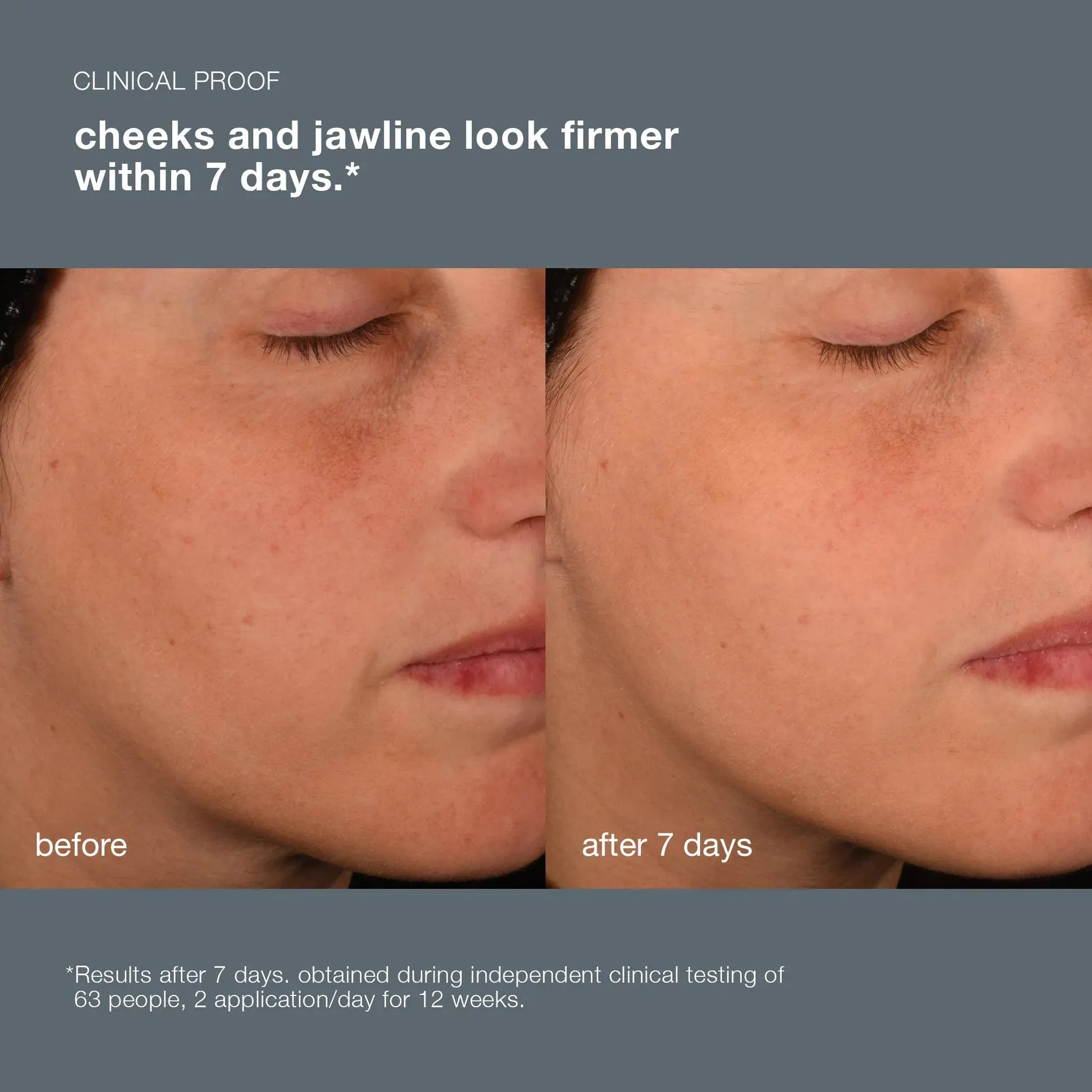 Dermalogica Pro-Collagen Banking Serum