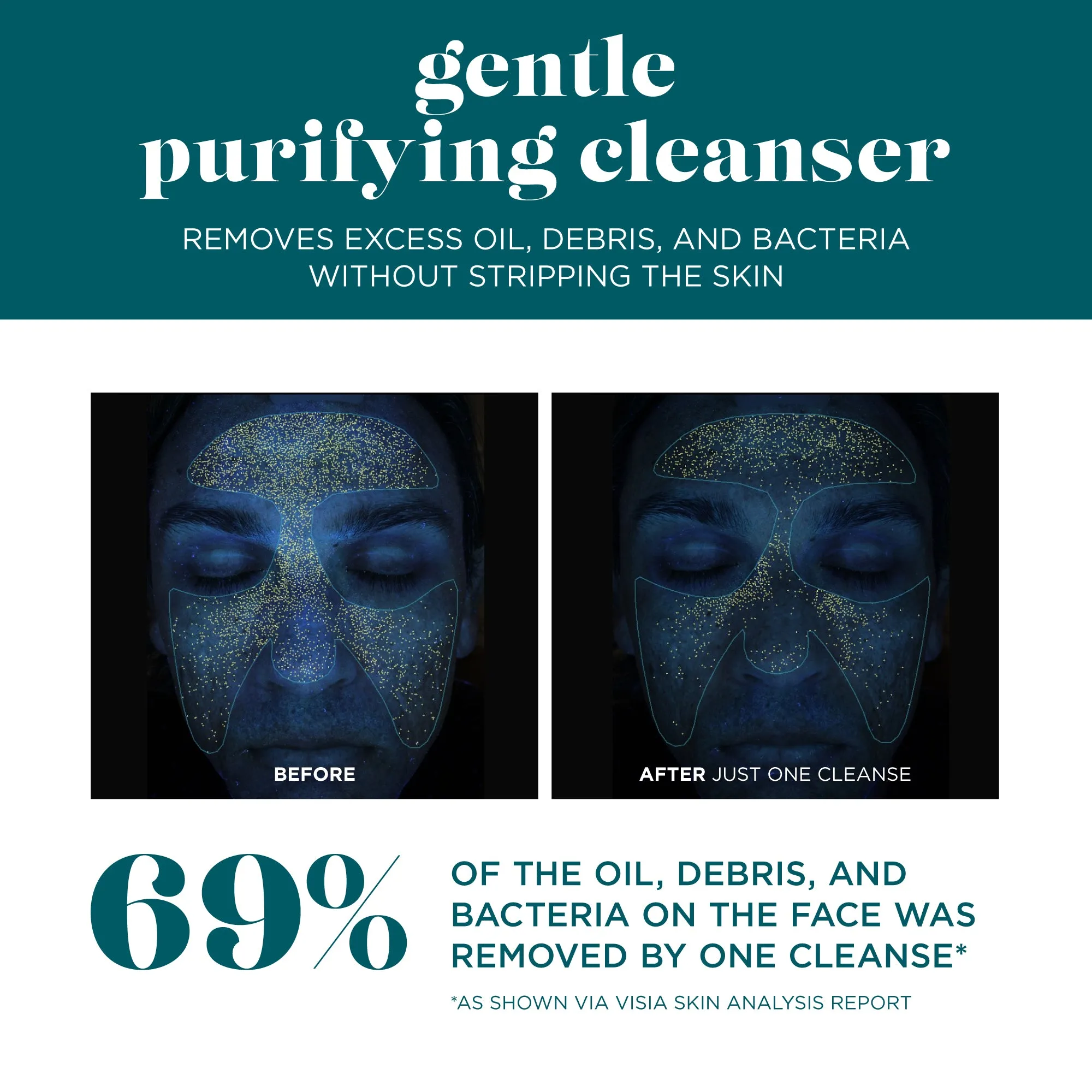 Gentle Purifying Cleanser
